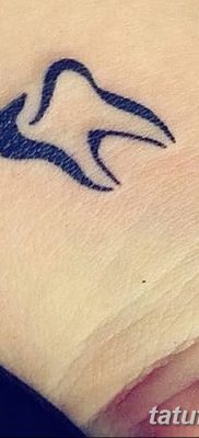 fotó egy fogtetoválásról, kelte: 2017. 09. 13. №102 - tetoválásfog -