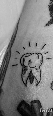 fotó egy fogtetoválásról, kelte: 2017.09.13. №116 - tetovált fog -