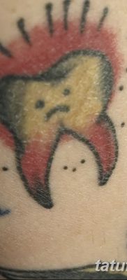 fotó egy fogtetoválásról, kelte: 2017.09.13. №131 - tetovált fog -