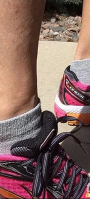 fotó tetoválás foga kelt 2017. 09. 13 -án №134 - tetoválófog -