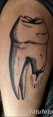 fotó egy fogtetoválásról, keltezés: 2017.09.13., 003 - tetovált fog -