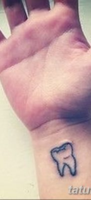 fotó egy fogtetoválásról, kelte: 09.09.2017 №004 - tetoválásfog -