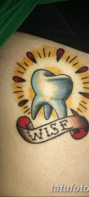 fotó egy fogtetoválásról, kelte: 09.09.2017 №005 - tetoválásfog -