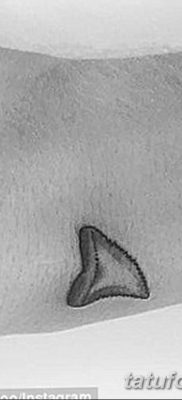 fotó egy fogtetoválásról, kelte: 09.09.2017 №006 - tetovált fog -