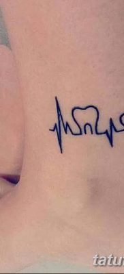 fotó egy fogtetoválásról, kelte: 2017.09.13. №022 - tetovált fog -