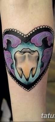 fotó egy fogtetoválásról, kelte: 2017.09.13. №023 - tetovált fog -