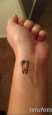 fotó egy fogtetoválásról, kelte: 2017.09.13. №027 - tetovált fog -