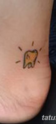 fotó egy fogtetoválásról, kelte: 2017.09.13. №029 - tetovált fog -
