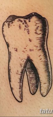 fotó egy fogtetoválásról, kelte: 2017. 09. 13. №030 - tetovált fog -
