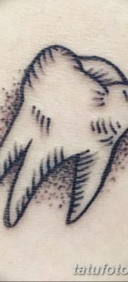 fotó egy fogtetoválásról, kelte: 2017.09.13. №034 - tetovált fog -