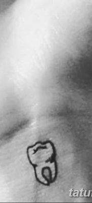 fotó egy fogtetoválásról, kelte: 2017. 09. 13. №040 - tetoválásfog -