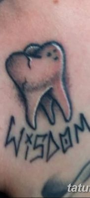 fotó egy fogtetoválásról, kelte: 2017.09.13. №045 - tetovált fog -