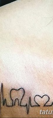 fotó egy fogtetoválásról, kelte: 2017.09.13. №047 - tetovált fog -