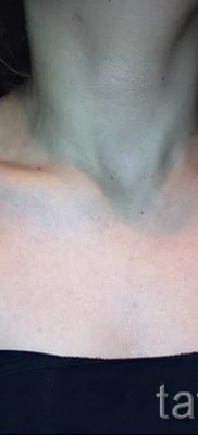 Fotó a csillag tetoválásról a kulcscsonton - példa 17122015 72. sz