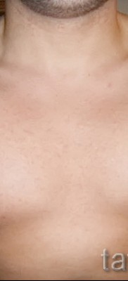 Fotó a csillag tetoválásról a kulcscsonton - példa 17122015 31. szám